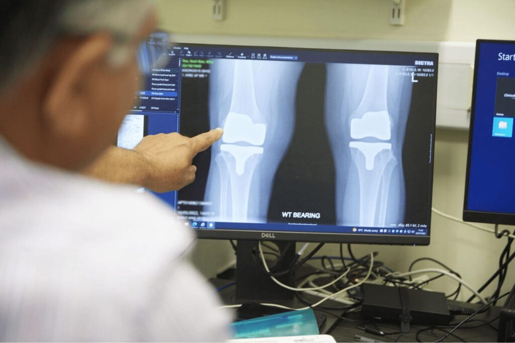 a doctor inspecting a knee xray