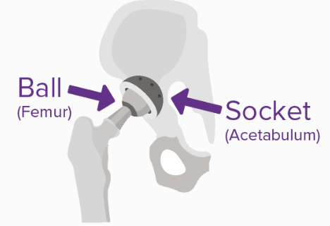 A diagram of a hip ball and socket