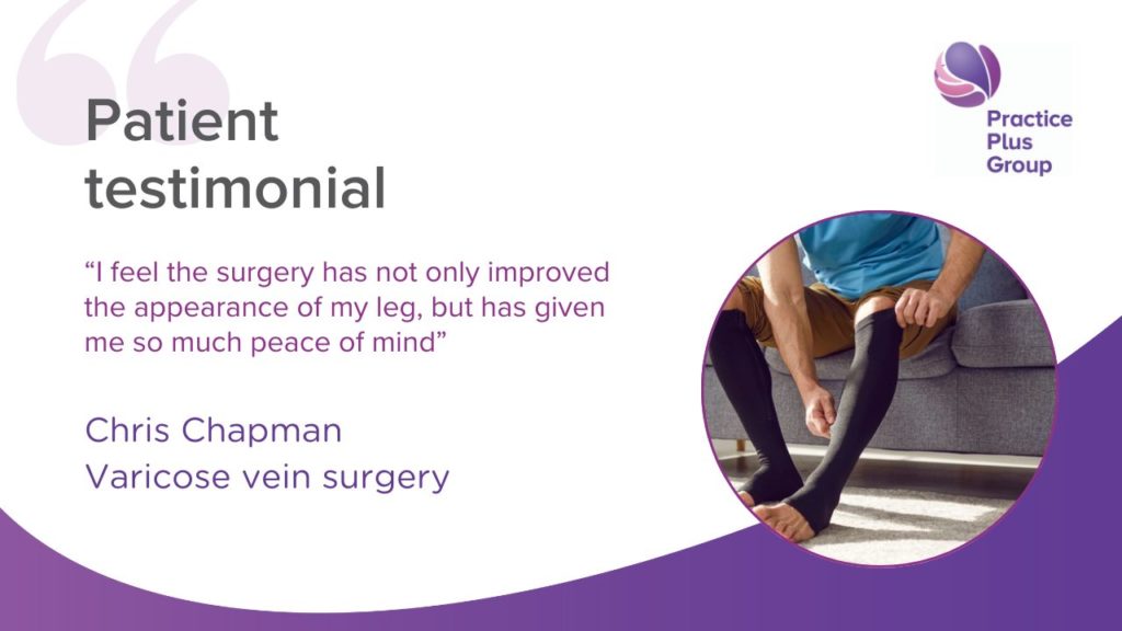 Varicose vein patient testimonial. click image to read the full patient testimonial. 