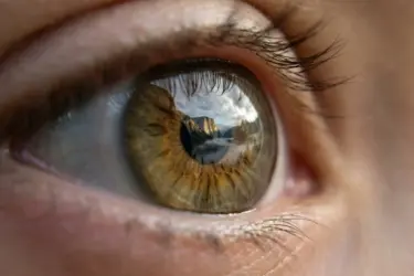 close-up of an eye, yag laser treatment