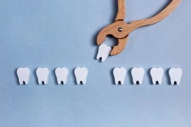 tooth extraction image